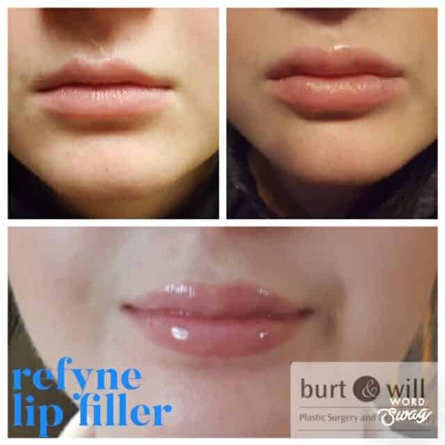 How To Get Certified To Do Lip Injections? 