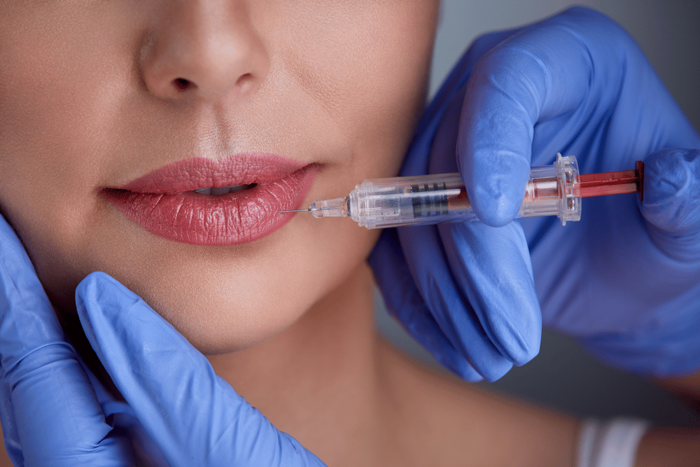What Does Lip Augmentation Mean 637366087651543522 - What Does Lip Augmentation Mean?