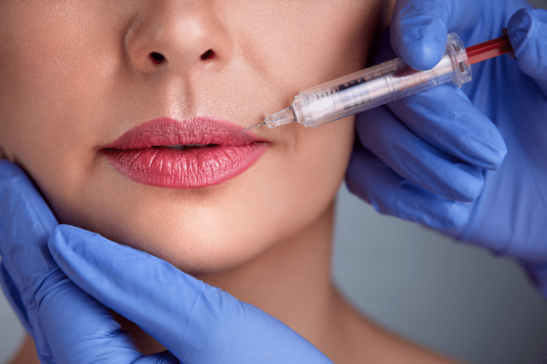 What Is Permanent Lip Augmentation? Will Plastic Surgery