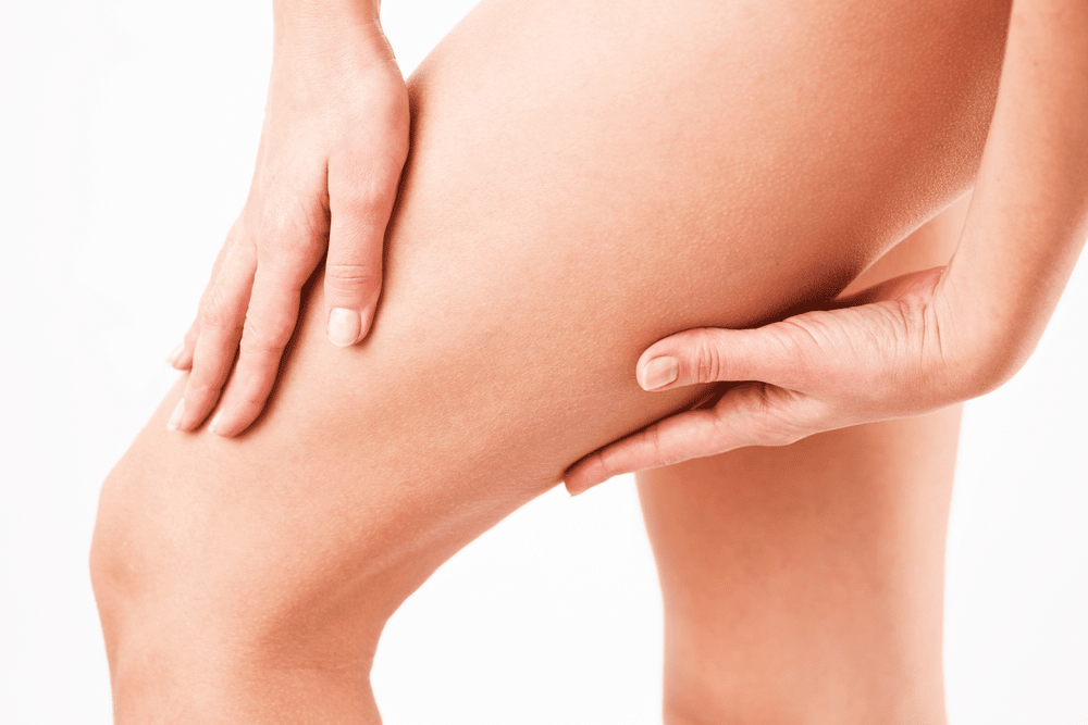 How Long Will a Thigh Lift Last 637999422097214695 - How Long Will a Thigh Lift Last?