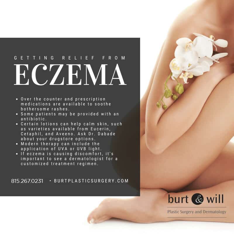 An image describing how to get relief from eczema